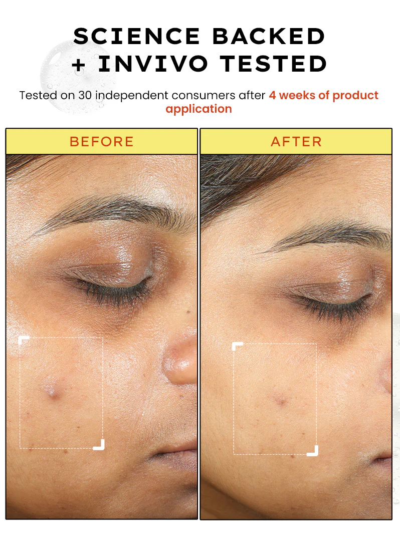 10% VITAMIN C SERUM with 1% [VITAMIN E + FERULIC ACID] - 20ml - Image 8