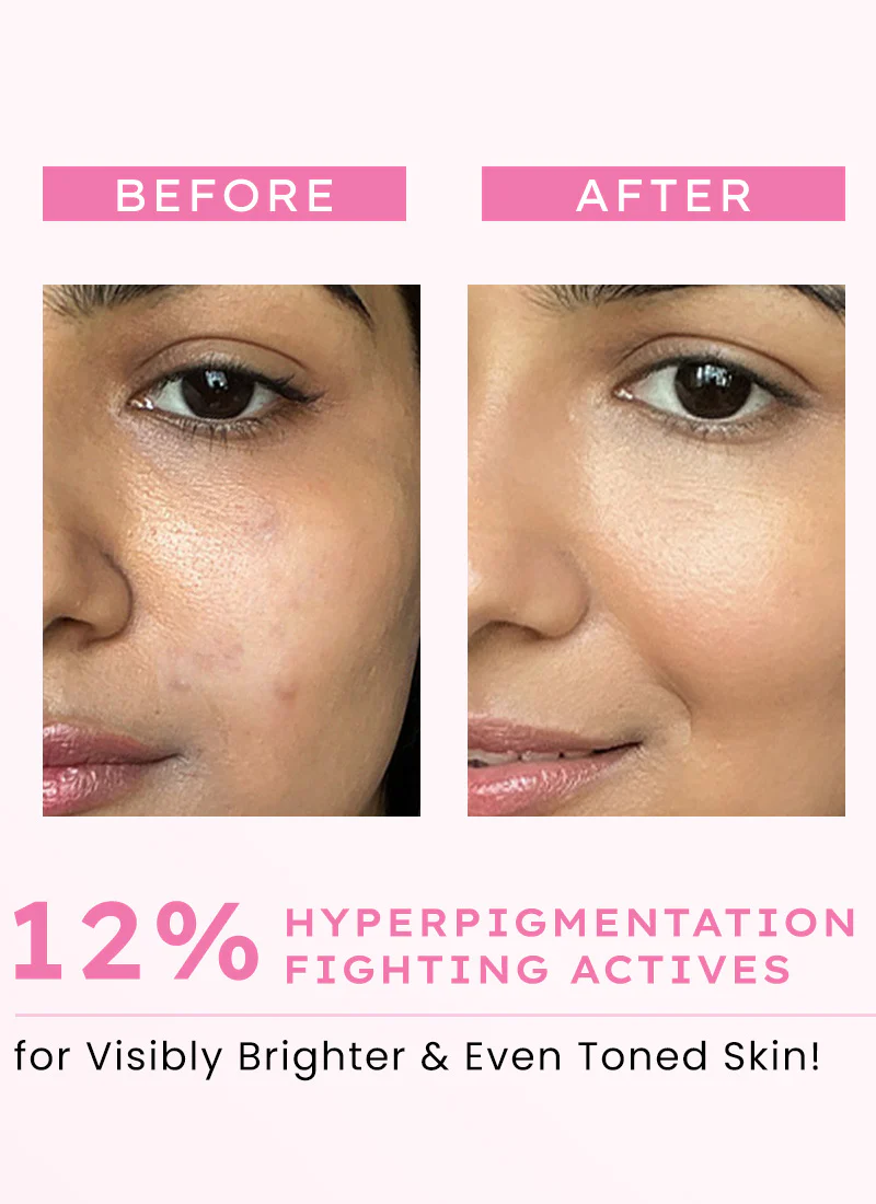 Advanced Glow Serum With 3% Tranexamic Acid & 2% Kojic Acid - 30 ml - Image 4