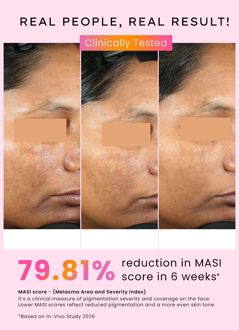 Dual Phase De-pigmentation Serum | 4% Tranexamic Acid- 30ml - Image 3