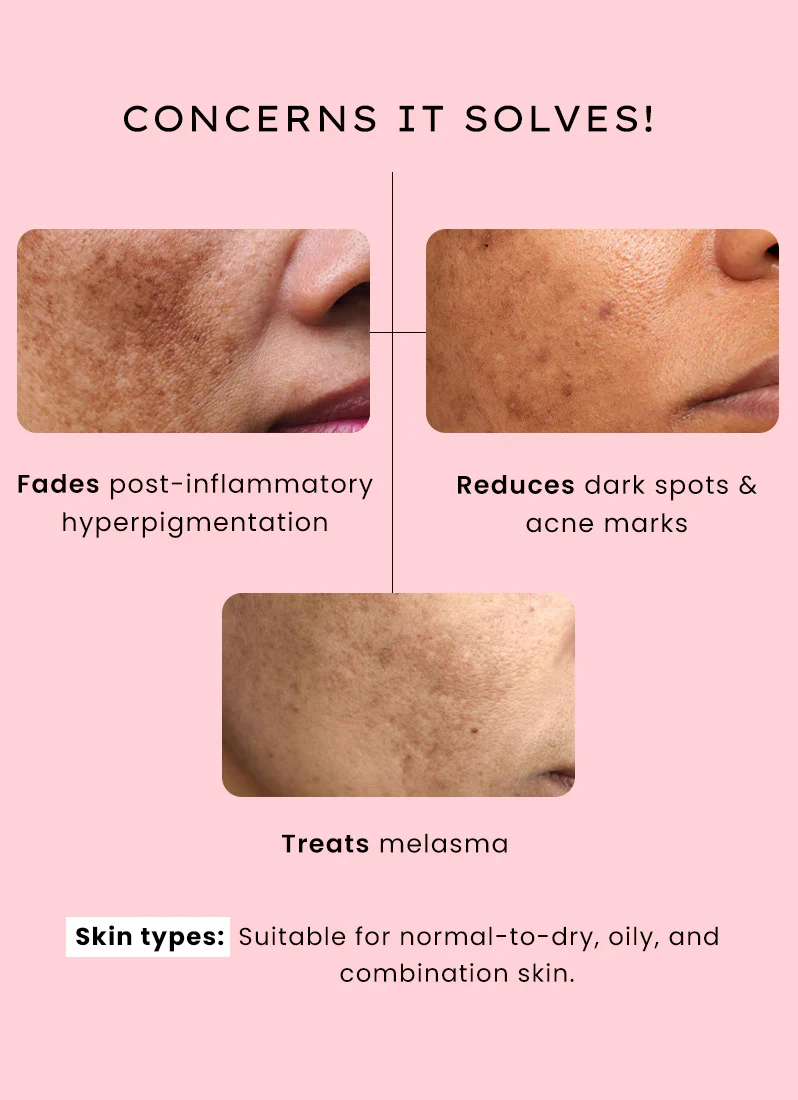 Dual Phase De-pigmentation Serum | 4% Tranexamic Acid- 30ml - Image 8