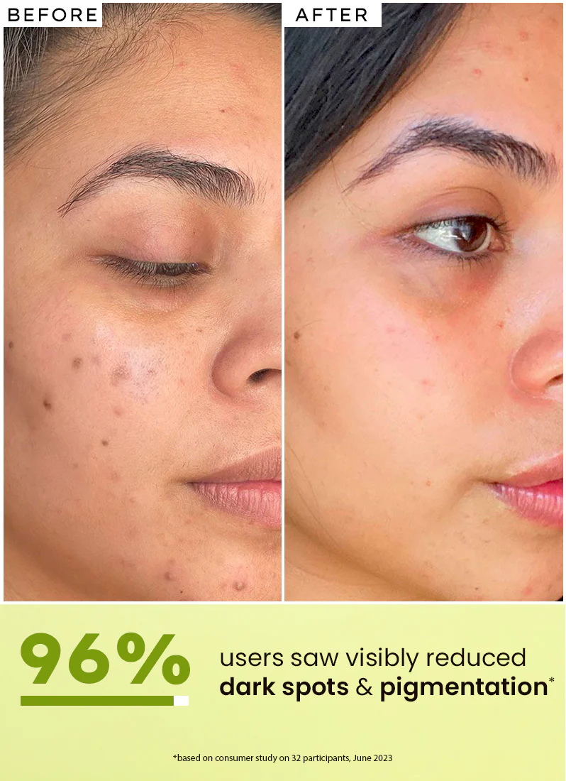 Golden Hour Glow Serum | 5% niacinamide, 1% alpha arbutin- 30 ml - Image 4