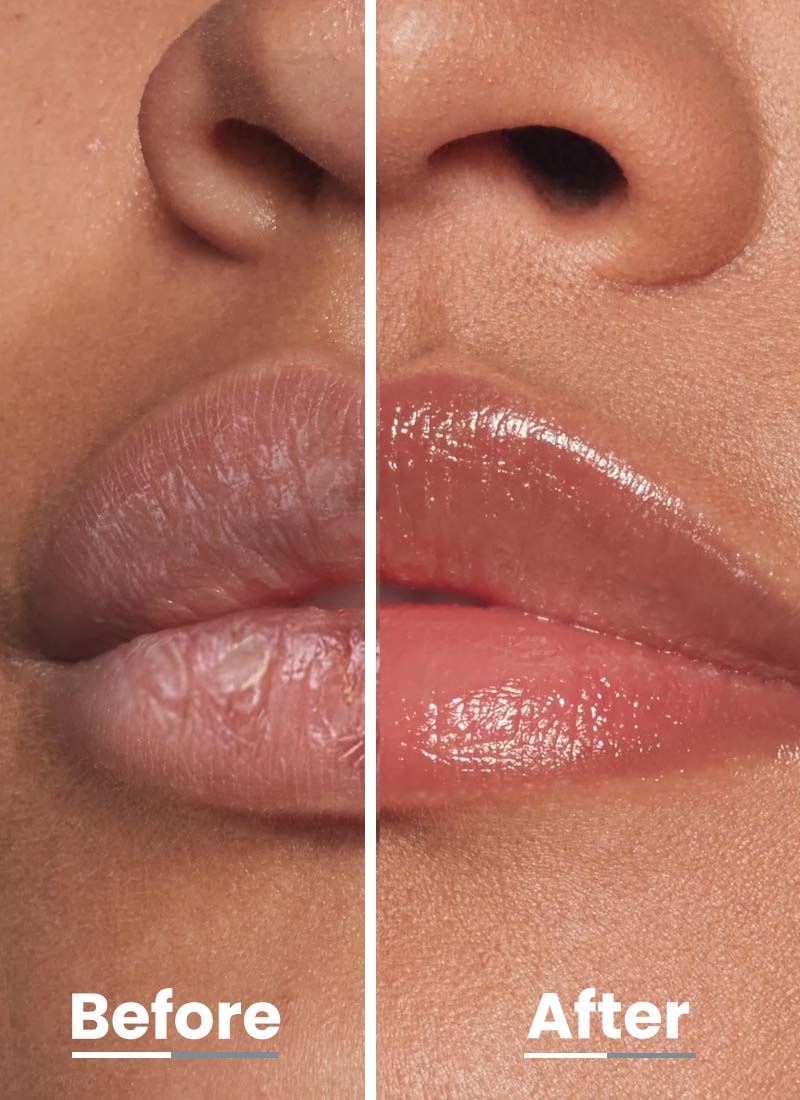 VITAMIN INFUSED PEPTIDE LIP BALM - PEACH 10G - Image 6